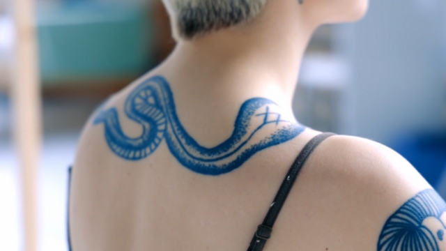 Tetovaža u plavoj boji prelazi preko ramena žene tokom pripreme za lasersko uklanjanje